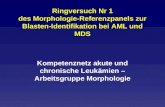 Ringversuch Nr 1 des Morphologie-Referenzpanels zur Blasten-Identifikation bei AML und MDS Kompetenznetz akute und chronische Leukämien – Arbeitsgruppe.