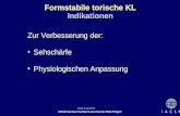 97111-1S.PPT IACLE German Contact Lens Course Slide Project I A C L E Formstabile torische KL Zur Verbesserung der: Sehschärfe Physiologischen Anpassung.