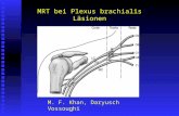 MRT bei Plexus brachialis Läsionen M. F. Khan, Daryusch Vossoughi.