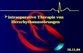 intraoperative Therapie von Herzrhythmusstörungen 16.11.04.