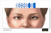 AUTOMÁTICO Der Ausdruck Schielen (Strabismus) bezeichnet eine Augenmuskelgleich- gewichtsstörung bzw. fehlerhafte motorische Koordination beider Augen.