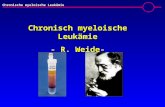 Chronische myeloische Leukämie Chronisch myeloische Leukämie - R. Weide-