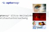 1 optomap ® Ultra-Weitwinkel Netzhautuntersuchung.