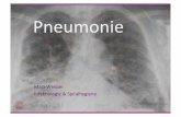 Pneumonie PD Dr. M. Weisser.pdf