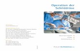 Operation der Schilddrüse - forum- · PDF filerung eines Kropfes (Struma), zur Behandlung von heißen