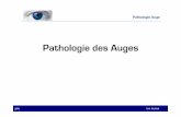 Pathologie des Auges - …sdeceaed5a9bf4e47.jimcontent.com/download/version/1389351087/... · Hordeolum = ….eine eitrige, schmerzhafte, bakterielle Entzündung der Drüsen (Zeiss