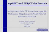 mpMRT und PET/CT der Prostata - esio.info · PI-RADS ™ Prostate Imaging – Reporting ... Score Peripheral Zone (PZ) or Transition Zone (TZ) 1 No abnormality (i.e., normal) on ADC