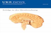 Erfolge in der Hirnforschung - UKE€¦ · die Attraktivität des Medizinstudiums in Hamburg für ... Fachklinik für Neurologische Frührehabilitation ... 44 Ein-Bett-Zimmer und