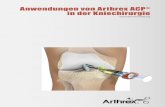 Anwendungen von Arthrex ACP ® in der Kniechirurgie · Nachbehandlung Bis 2 Wochen ... osteotomie, buttons, platelet derived growth factor, mikrofrakturierung, ... allograft, dovetail-meniskus-allograft-set,