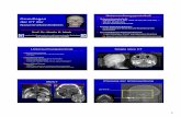Grundlagen der CT der 120 KV, 20-150 mAs Axiale ... · 9 Sinus frontalis Entwickelt sich nach der Geburt Kann hypoplastisch oder aplastisch sein Frontal Knochenmark Multiple Sinus