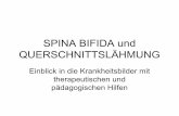 SPINA BIFIDA und QUERSCHNITTSLÄHMUNG - scheel-schule.de Spina Bifida.pdf · Gliederung • 1.Definitionen Spina bifida ,Querschnittslähmung • 2.Ursachen • 3.Zusammenhang •