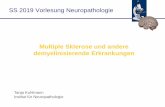 SS 2019 Vorlesung Neuropathologie · Multiple Sklerose (MS) ist die häufigste entzündlich demyelinisierende Erkrankung des ZNS MS ist die häufigste Ursache für eine Behinderung