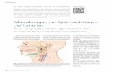 Erkrankungen der Speicheldrüsen – die Tumoren · PDF fileca. 7 % der Kopf ­Hals ­Tumoren treten in den Speicheldrüsen auf. Die häufigsten Tumoren sind epithelialen Ursprungs