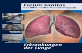Erkrankungen der Lunge - forum-sanitas.com · Jetzt wissen wir endlich, warum Ihre Lungenfunktion so schlecht ist. Sie haben einen Alpha-1-Antitrypsin-Mangel und deswegen ein Lungen-emphysem.