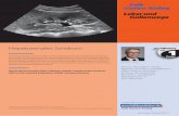 FGK 1 17 Gerbes Web - drfalkpharma.de · Falk Gastro-Kolleg 1/2017 | 5 Die Datenlage ist für Terlipressin als Vasokonstriktor am überzeugendsten, weshalb eine Kombination aus Albumin