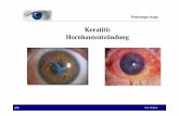 Keratitis Hornhautentzündungsdeceaed5a9bf4e47.jimcontent.com/download/version/1389351422/module/... · Ablatio Retinae! gibb kim bichsel Pathologie Auge !! • Verletzungen des Auges