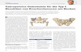 B. Fuchs, Sakropelvine Osteotomie für ... · 36 Orthopädie & Rheumatologie 4 / 2018 Referat TUMORORTHOPÄDIE vasiv mit der Information aus CT- und MRI-Bildgebung 3D-gedruckt und