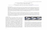 Ein genauer Blick auf die optische Hebung fileSchulbücher und Lehrwerke der Optik mit unterschiedlichen und oft widersprüchlichen Darstel- lungen zum Phänomen der optischen Hebung.