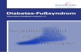 Diabetes-Fußsyndrom - eurocom-info.de · Diabetes mellitus Typ 1 oder Typ 2 erkrankt sind. Eine schwerwiegende Folge ist das Diabetes-Fußsyndrom (DFS), das schlimmstenfalls zu Amputationen