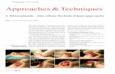 Rhinochirurgie Approaches & Techniques · 4 Camouflage Shield graft 2 3 4 Abb. 6c. 28I I Fachbeitrag _ Rhinochirurgie _Tip grafts Sie können auf den Domen als trapezförmige Transplantate