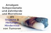 Amalgam und Zahnherde und Borreliose als - homeopathy.at Basel Krebsseminar/6-Amalgam Druckvorlage NEU.pdf · Amalgam (c) Dr. Retzek 2015 1 Amalgam Schwermetalle und Zahnherde und