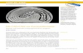 Mit CAD/CAM zur Kunststoffschieneähne-zahnersatz.de/images/Downloads/Publikationen/2014/qz... · virtuellen Artikulator den Stützstift auf die gewünschte Erhöhung ein. In der