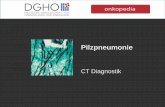 CT Diagnostik - onkopedia.com filedichtes pulmonales Infiltrat ; auf den ersten Blick können die vorliegenden Spiculae mit einem Halo verwechselt werden . Pulmonale Metastase eines