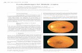 Fundusblutungen bei Malaria tropica - CORE · PDF fileFundusblutungen bei Malaria tropica manifesten disseminierten intravasalen Koagulation (19,73)] und einer durch Endothelaktivierung