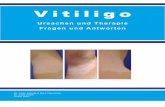 Viti Flyer 2011/1 - vitiligo-bund.de · Hautverletzungen eine Vitiligo auslösen können. Diese Vorkommnisse scheinen aber nicht die eigentliche Ursache der Viti-ligo zu sein. Da