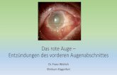 Das Rote Auge...Episkleritis •gutartige, selbstlimitierende entzündliche Erkrankung •eine häufige Erkrankung •durch das plötzliche Einsetzen einer schmerzlosen Augenrötung