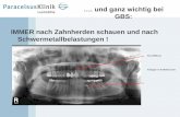 und ganz wichtig bei - gbsinfo.ch · NT-Injection ans Ganglion Stellatum Technique: • Puncture: install the head backwards, turned to the opposite side, two fingers push back the