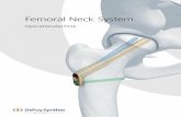 Oper Mobile/Synthes... 4 DePuy Synthes Femoral Neck System (FNS) Operationstechnik MRT-Informationen