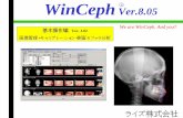 WinCeph - risecorp.co.jp · EPSON Scan Ver1.01Jを使用してのレントゲン取込について記し ます。他のメーカーのスキャナーや違うバージョンのドライバーを