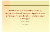 Méthodes d’ondelettes pour la segmentation d’images. … · 2004-09-24 · Méthodes d’ondelettes pour la segmentation d’images. Applications à l’imagerie médicale et