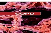 COPD - aerztezeitung.at · Während die Zahl der kardiovaskulär bedingten Todesfälle zwischen 1980 und 2000 deutlich um mehr als 50 Prozent zurückgegangen ist, war bei den durch