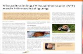 Visualtraining/Visualtherapie (VT) nach Hirnschädigung · Ein neugeborenes Baby kann das alles noch nicht. Eigentlich ist es fertig, es hat Arme, Beine, Augen, Ohren, Mund und die