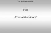 Aucun titre de diapositive · Folie 2 Fall Prostatakarzinom Bei der Anamnese berichtet der Patient zunächst spontan, dass er seit mehreren Jahren bereits einen etwas verminderten