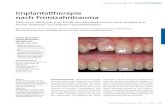 Implantattherapie nach Frontzahntrauma€¦ · Ahangari 2010). Eine Therapieoption ist die frühe Extraktion des ankylosierten Zahnes und seine spätere prothetische Reha bilitation.