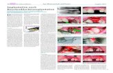 Implantation nach Knochenblocktransplantationcms.kometdental.de/fileadmin/_migrated/media/Du__rholt_Teil7_KW28.… · 12 Die ZahnarztWoche Aus Wissenschaft und Praxis Ausgabe 28/11
