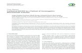 Case Report Unilateral RS3PE in a Patient of Seronegative ...downloads.hindawi.com/journals/crirh/2013/923797.pdf · symptoms were well controlled with DMARDs, and patient developed