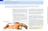 swg Lewalter Kardioversion V - Thieme€¦ · Empfehlungen zur externen Kardioversi-on bei Patienten mit Herzschrittmacher oder implantier - tem Kardioverter / Defibrillator. Kardiologe