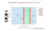 S2 S1 S2 - Sektion Physik2D-Waveguides als (erste) Optik des Nanofokus-Messplatzes Pfeiffer et al., ESRF Highlights 2005 • Elektronenstrahllithographie • Kanal aus PMMA (Polymer)