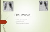 Pneumoniaantibiotikum kombinálása szükséges!/ meropenem hatásosabb,mint az imipenem/,aminoglucosidok Ceftazidimet Penicillin G-vel kell kombinálni, hogy S.pneumoniae-ra is hassunk;