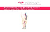 Behandlung von Durchblutungs- störungen der Beinarterien · periphere arterielle Verschlusskrankheit (PAVK) bezeichnet und entsprechend ihrem Schweregrad in vier Stadien unterteilt: