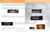 Sonografie Ultraschall- untersuchung Warum Ultraschalluntersuchungen? · PDF file 2018. 7. 29. · Sonografie Ultraschall-untersuchung Commission Romande de Physique DPK Deutschschweizerische