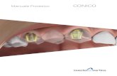 Manuale Protesico CONICO - Sweden & Martina · 2020. 5. 29. · La protesi conometrica è da ritenersi una protesi fissa, al pari delle soluzioni avvitate e cementate e ne racchiude