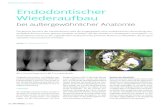 Rekonstruktion // Fallbericht Endodontischer Wiederaufbau ten Prothese auf Zahn 26. Der Zahn war beim