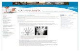 Arthritis of the Wrist - osteoarthritis and rheumatoid arthritis. Osteoarthritis Osteoarthritis (OA)